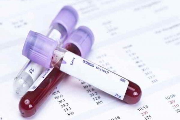 La opción más confiable es la prueba en sangre. Prueba embarazo sangre