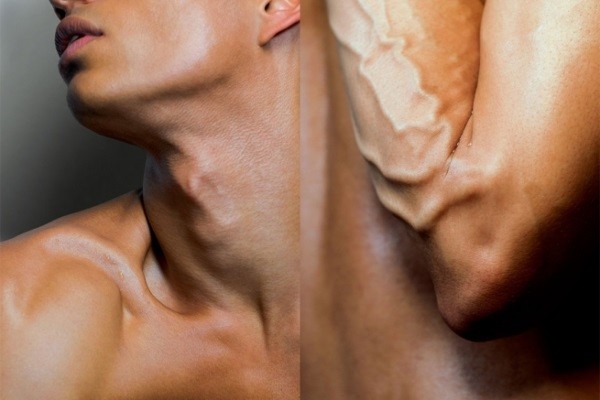 Florian Hetz 3